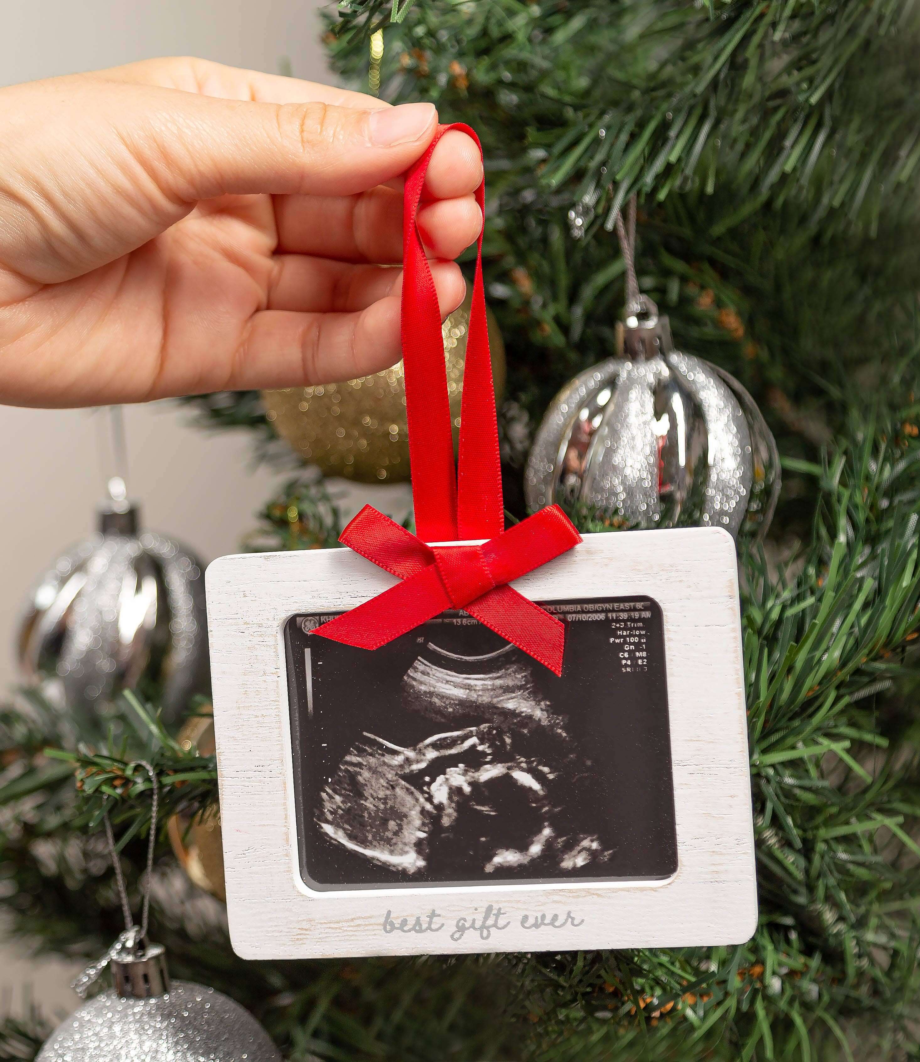 Personalized Sonogram Ornaments Brushed Acrylic Ultrasound